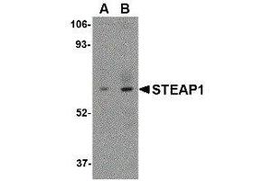 Western Blotting (WB) image for anti-Six Transmembrane Epithelial Antigen of The Prostate 1 (STEAP1) (C-Term) antibody (ABIN2476601) (STEAP1 Antikörper  (C-Term))