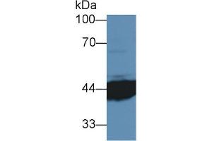 Detection of IL3Ra in Human MCF7 cell lysate using Polyclonal Antibody to Interleukin 3 Receptor Alpha (IL3Ra) (IL3RA Antikörper  (AA 167-331))