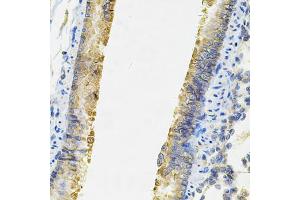Immunohistochemistry of paraffin-embedded rat lung using ACSS2 Antibody (ABIN6292756) at dilution of 1:100 (40x lens). (ACSS2 Antikörper)