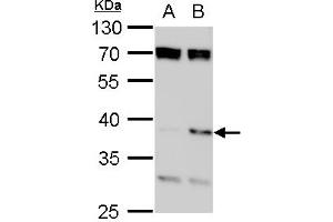 WB Image SET antibody, isoform 2-specifc detects SET protein by western blot analysis. (SET/TAF-I Antikörper  (N-Term))