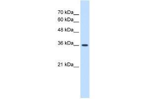 WB Suggested Anti-MAS1 Antibody Titration:  1. (MAS1 Antikörper  (Middle Region))
