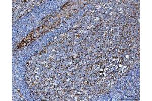 IHC analysis of CD276 using anti-CD276 antibody (ABIN7601136).