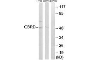 Western blot analysis of extracts from LOVO/HT-29 cells, using GABRD Antibody. (GABRD Antikörper  (AA 141-190))