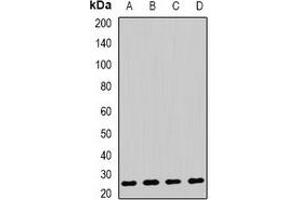 Western blot analysis of AK4 expression in HepG2 (A), Raji (B), mouse liver (C), mouse kidney (D) whole cell lysates.