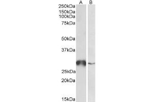 ABIN5539847 (0. (GSTO1 Antikörper  (Internal Region))