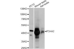 Western blot analysis of extracts of various cell lines, using PDHA2 antibody (ABIN6293729) at 1:1000 dilution. (PDHA2 Antikörper)