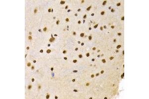 Immunohistochemistry of paraffin-embedded mouse brain using DNMT3A Antibody (ABIN1872325) at dilution of 1:100 (40x lens). (DNMT3A Antikörper)