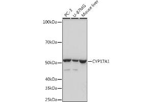 Western blot analysis of extracts of various cell lines, using CYP17 Rabbit mAb (ABIN7266648) at 1:1000 dilution. (CYP17A1 Antikörper)