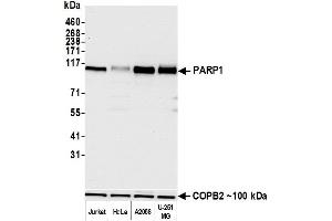 Western Blotting (WB) image for anti-Poly (ADP-Ribose) Polymerase 1 (PARP1) (AA 750-800) antibody (ABIN7449531)