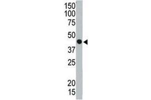 Western blot testing of TSG101 antibody and ZR75-1 cell lysate. (TSG101 Antikörper  (AA 340-370))