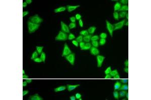 Immunofluorescence analysis of HeLa cells using ADSL Polyclonal Antibody (Adenylosuccinate Lyase Antikörper)