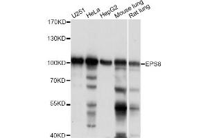 Western blot analysis of extracts of various cell lines, using EPS8 antibody. (EPS8 Antikörper)