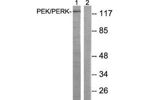 Western Blotting (WB) image for anti-Eukaryotic Translation Initiation Factor 2-alpha Kinase 3 (EIF2AK3) (Thr981) antibody (ABIN1848259) (PERK Antikörper  (Thr981))