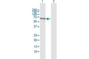 Western Blot analysis of PPM1J expression in transfected 293T cell line by PPM1J MaxPab polyclonal antibody. (PPM1J Antikörper  (AA 1-505))