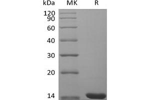 Western Blotting (WB) image for Fibroblast Growth Factor 4 (FGF4) protein (ABIN7320894)