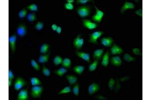 Immunofluorescence staining of Hela cells with ABIN7169187 at 1:100, counter-stained with DAPI. (TAO Kinase 1 (TAOK1) (AA 400-659) Antikörper)