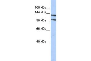 WB Suggested Anti-RBM5 Antibody Titration:  0. (RBM5 Antikörper  (N-Term))
