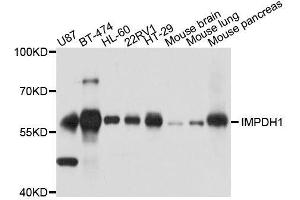 Western blot analysis of extracts of various cell lines, using IMPDH1 antibody. (IMPDH1 Antikörper  (AA 434-563))