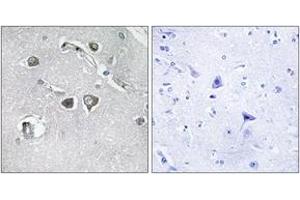 Immunohistochemistry analysis of paraffin-embedded human brain tissue, using Collagen XI alpha2 Antibody. (COL11A2 Antikörper  (AA 1211-1260))