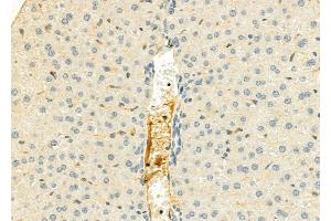 ABIN6262859 and ABIN6276807 at 1/100 staining Mouse liver tissue by IHC-P.