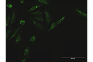 Immunofluorescence of purified MaxPab antibody to TIMM44 on HeLa cell. (TIMM44 Antikörper  (AA 1-452))