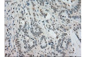 Image no. 1 for anti-Budding Uninhibited By Benzimidazoles 1 Homolog beta (Yeast) (BUB1B) antibody (ABIN1497000) (BUB1B Antikörper)