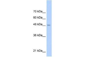 TLR6 antibody used at 1 ug/ml to detect target protein. (TLR6 Antikörper  (Middle Region))