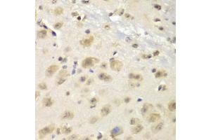 Immunohistochemistry of paraffin-embedded mouse brain using S100A10 antibody (ABIN5971035) at dilution of 1/100 (40x lens).