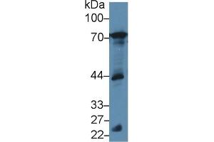 Detection of BLNK in Mouse Testis lysate using Polyclonal Antibody to B-Cell Linker Protein (BLNK) (B-Cell Linker Antikörper  (AA 65-314))