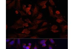 Immunofluorescence analysis of U2OS cells using GPER1 Polyclonal Antibody at dilution of 1:100. (Mesothelin Antikörper)
