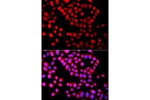 Immunofluorescence analysis of A549 cell using SETD6 antibody. (SETD6 Antikörper)