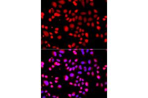 Immunofluorescence analysis of A549 cells using ASPSCR1 antibody (ABIN5975297). (ASPSCR1 Antikörper)