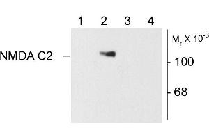 Western blots of 10 ug of HEK 293 cells showing specific immunolabeling of the ~120k NR1 subunit of the NMDA receptor containing the C2 splice variant insert. (GRIN1/NMDAR1 Antikörper)