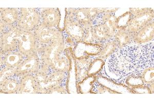 Immunohistochemistry (IHC) image for anti-Tumor Necrosis Factor Receptor Superfamily, Member 14 (TNFRSF14) (AA 41-209) antibody (ABIN7443230)