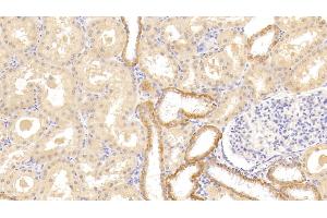 Detection of TNFRSF14 in Human Kidney Tissue using Polyclonal Antibody to Tumor Necrosis Factor Receptor Superfamily, Member 14 (TNFRSF14) (HVEM Antikörper  (AA 41-209))