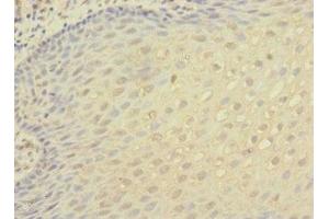 Immunohistochemistry of paraffin-embedded human tonsil tissue using ABIN7156472 at dilution of 1:100 (CD11c Antikörper  (AA 100-350))