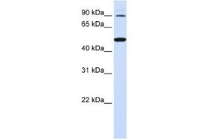 RHBDF1 antibody used at 1 ug/ml to detect target protein. (RHBDF1 Antikörper)