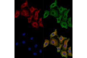 ABIN7094524 and ABIN7098573 staining Hela cells by IF/ICC.