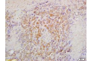 Formalin-fixed and paraffin embedded mouse lymphoma labeled with Rabbit Anti CRTAM Polyclonal Antibody, Unconjugated (ABIN1387894) at 1:200 followed by conjugation to the secondary antibody and DAB staining (CRTAM Antikörper  (AA 31-130))
