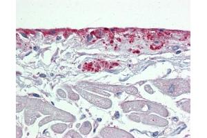 POSTN antibody was used for immunohistochemistry at a concentration of 4-8 ug/ml. (Periostin Antikörper  (N-Term))
