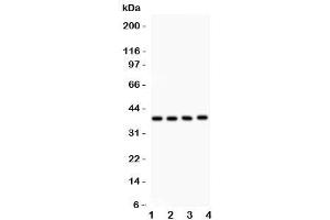 Western blot testing of IkB beta antibody and Lane 1:  mouse kidney