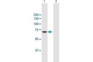 Western Blotting (WB) image for anti-TATA Box Binding Protein (TBP)-Associated Factor, RNA Polymerase I, B, 63kDa (TAF1B) (AA 1-588) antibody (ABIN948758)