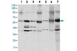 Western blot analysis of SRC monoclonal antobody, clone 1F11  against MCF-7 (1), A-431 (2), HeLa (3), HEK293 (4), NIH/3T3 (5), PC-12 (6) and COS-7 (7) cell lysate.