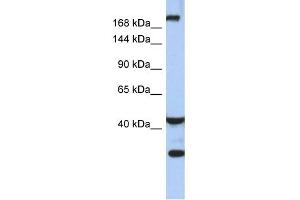 WB Suggested Anti-DISP1 Antibody Titration:  0. (DISP1 Antikörper  (Middle Region))