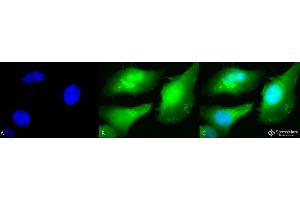Immunocytochemistry/Immunofluorescence analysis using Rabbit Anti-AKT2 Polyclonal Antibody . (AKT2 Antikörper  (C-Term) (Biotin))