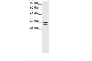 Image no. 3 for anti-HIV-1 Tat Interactive Protein 2, 30kDa (HTATIP2) (AA 30-79) antibody (ABIN202114) (HIV-1 Tat Interactive Protein 2, 30kDa (HTATIP2) (AA 30-79) Antikörper)