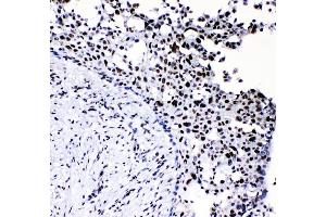 IHC analysis of NF1 using anti-NF1 antibody (ABIN7600195).