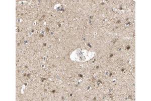 Immunohistochemistry (IHC) image for anti-Aurora Kinase A (AURKA) (pThr288) antibody (ABIN6256537)