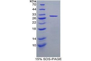 SDS-PAGE (SDS) image for Dihydrolipoamide Dehydrogenase (DLD) (AA 238-466) protein (His tag) (ABIN2124633) (DLD Protein (AA 238-466) (His tag))