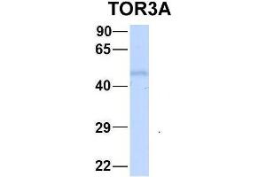 Host:  Rabbit  Target Name:  FAM46C  Sample Type:  Human Fetal Liver  Antibody Dilution:  1. (TOR3A Antikörper  (Middle Region))